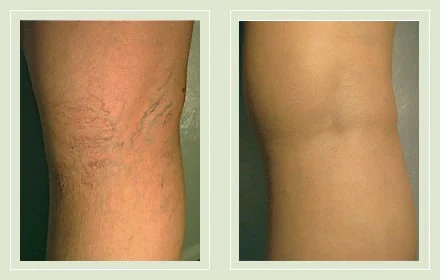 🔥2026 1-Second Airbrushed Leg Concealer🦵 - Image 5