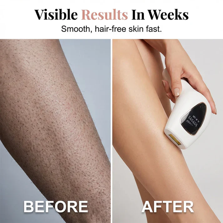 🔥LAST DAY 70%OFF🔥 Painless Hair Removal Device for Women - Image 8