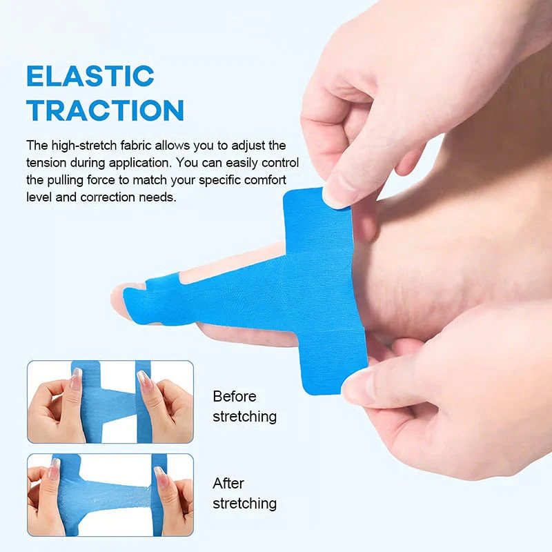 🔥LAST DAY 50% OFF - 👣Pre-cut Hallux Valgus Corrector Kinesiology Tape - Image 2