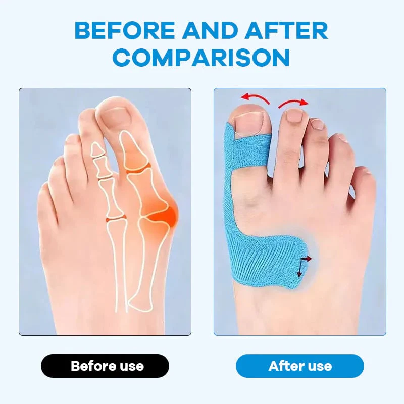 🔥LAST DAY 50% OFF - 👣Pre-cut Hallux Valgus Corrector Kinesiology Tape - Image 3