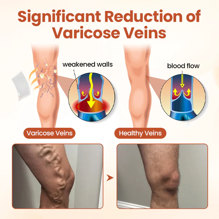 VeinTarget Microneedle Patch - Image 3